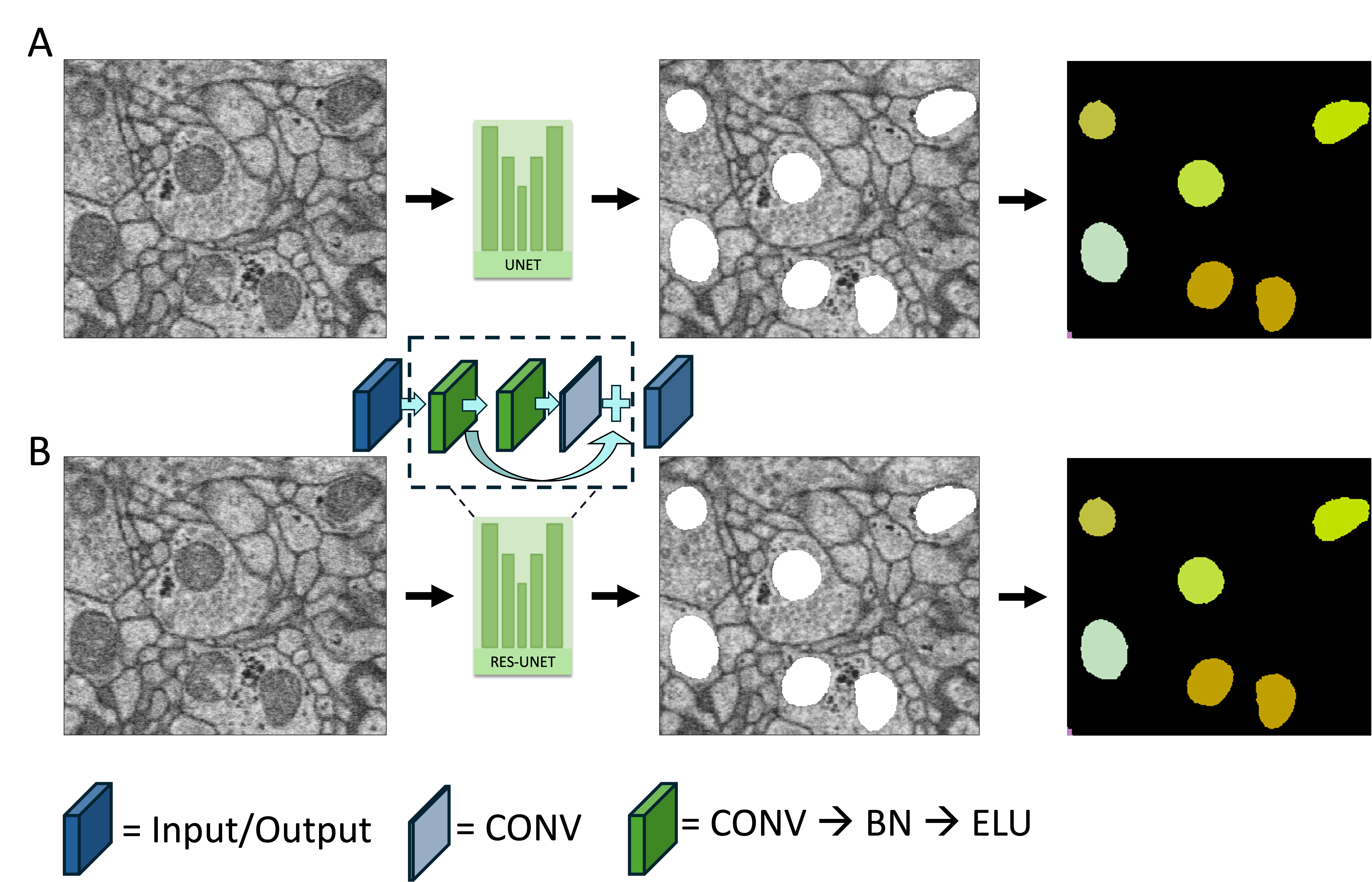 Mitochondria Segmentation