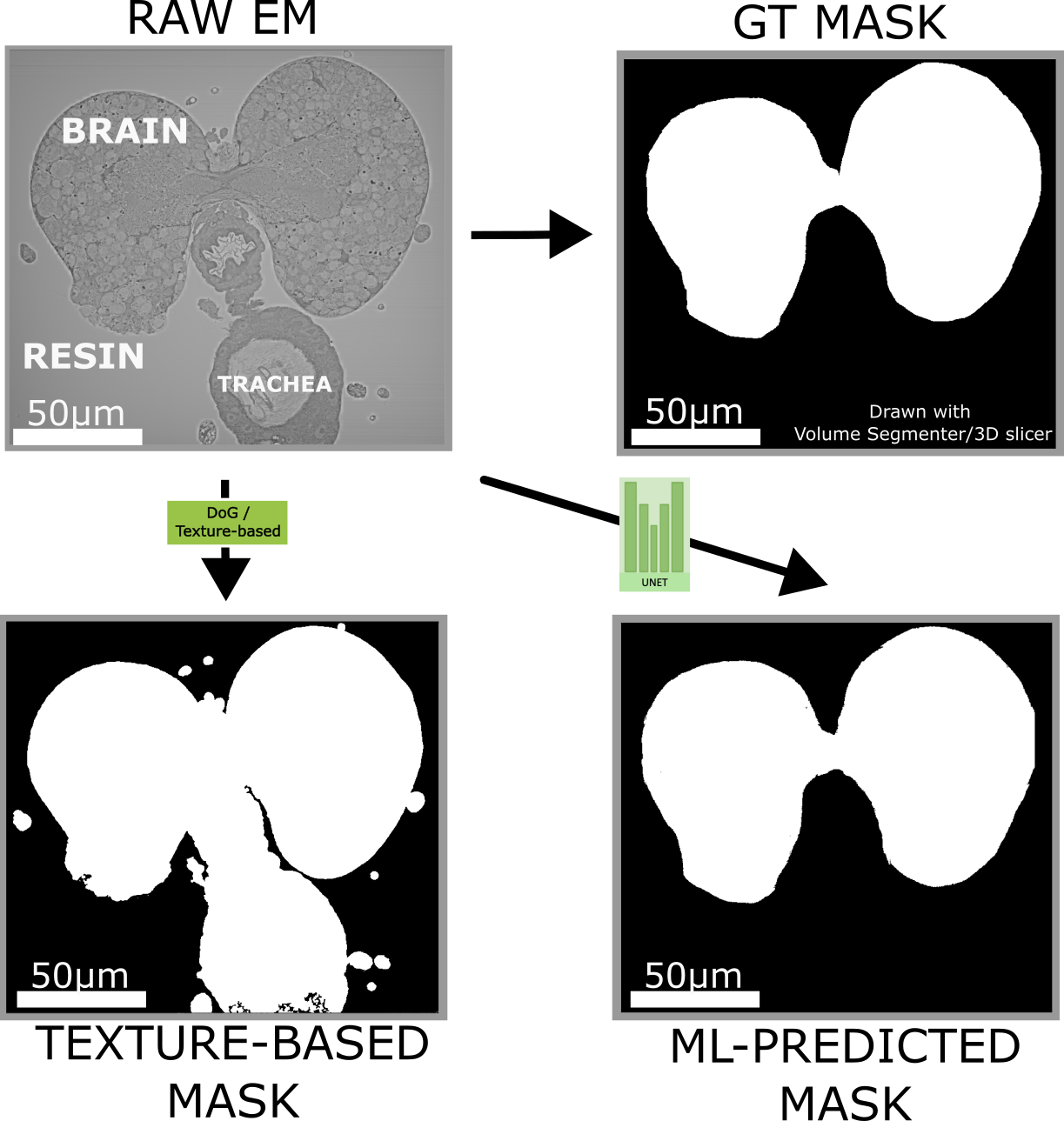 EM mask generation: brain vs non-brain