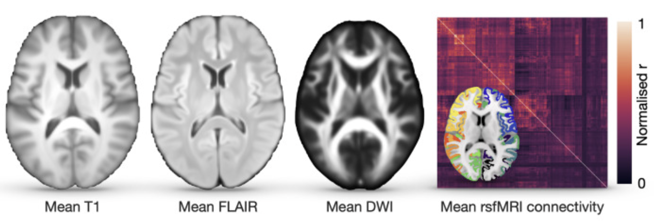 Computational limits to brain imaging legibility thumbnail